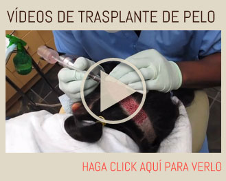 Hair transplant videos